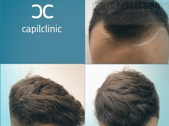 CapilClinic Madrid 