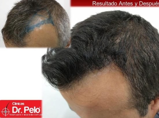 Clínicas Dr. Pelo Sevilla 