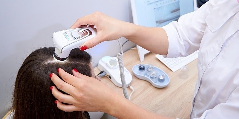 Tratamientos para la alopecia ⋆ 7 alternativas para tener en cuenta