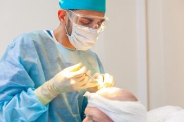 FUSS, FUE, DHI, ARTAS…¿Cuál es mejor?